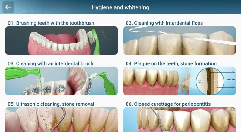 Hình ảnh minh họa ứng dụng Dental 3D Illustrations