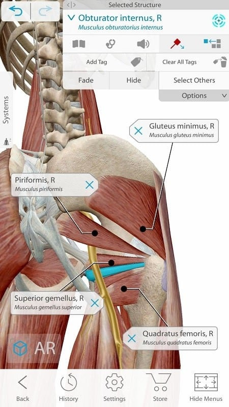 Learn about pathologies in Human Anatomy Atlas 2021